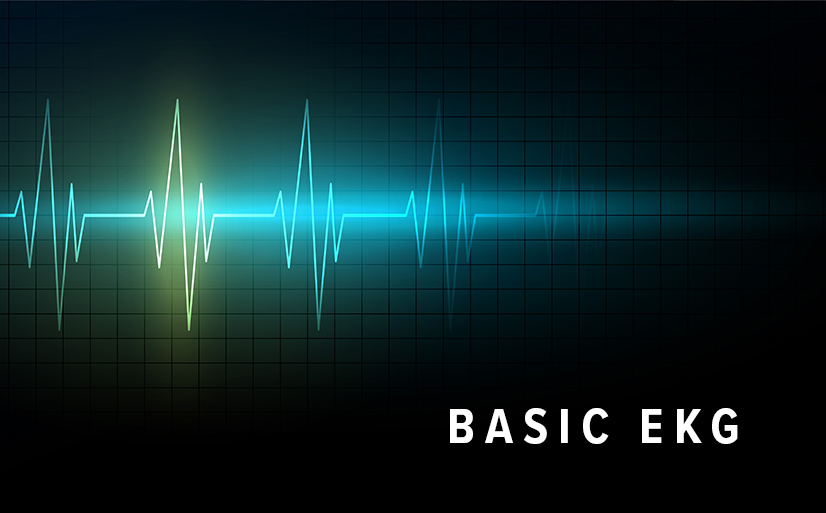 Basic EKG