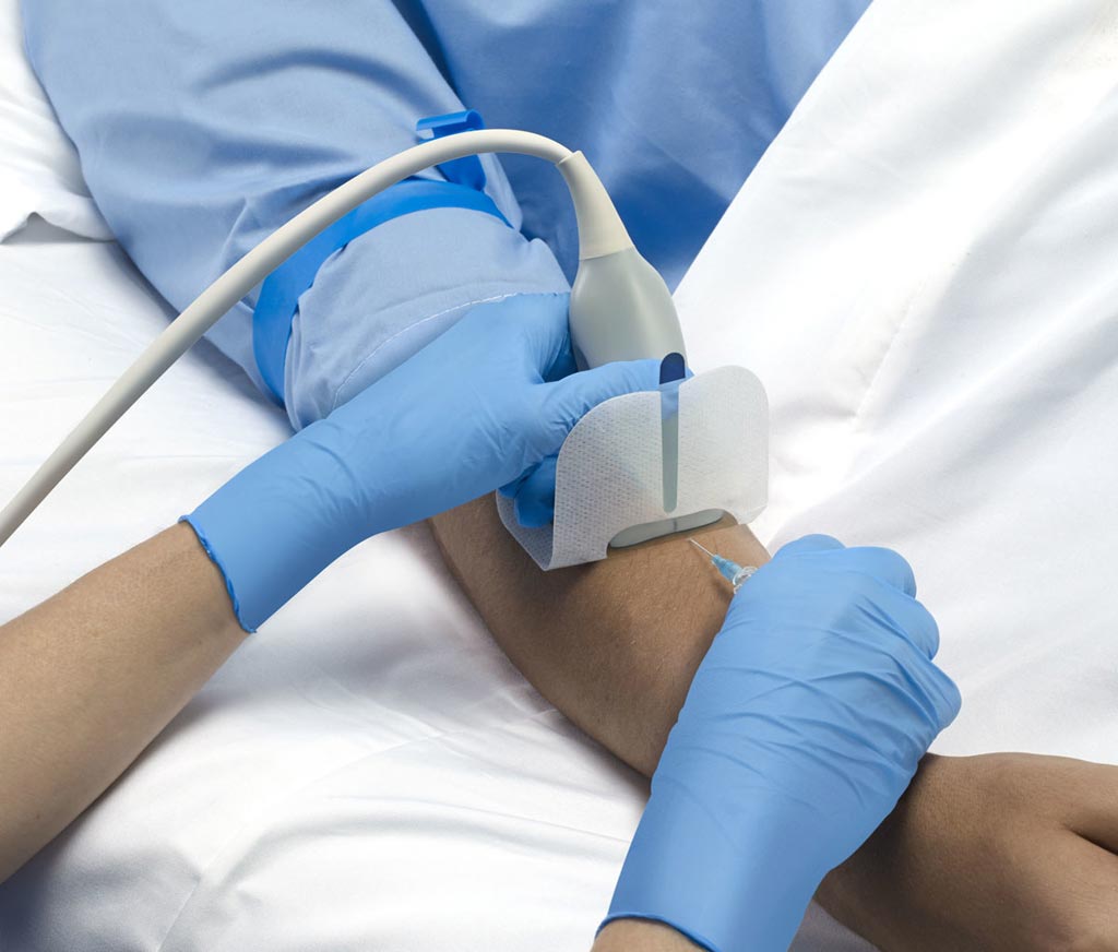 Ultrasound Use for Intravenous Insertion- SARH Staff Only