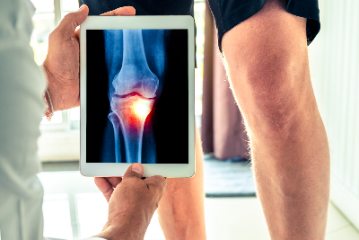 Is it time to get your knee replaced?